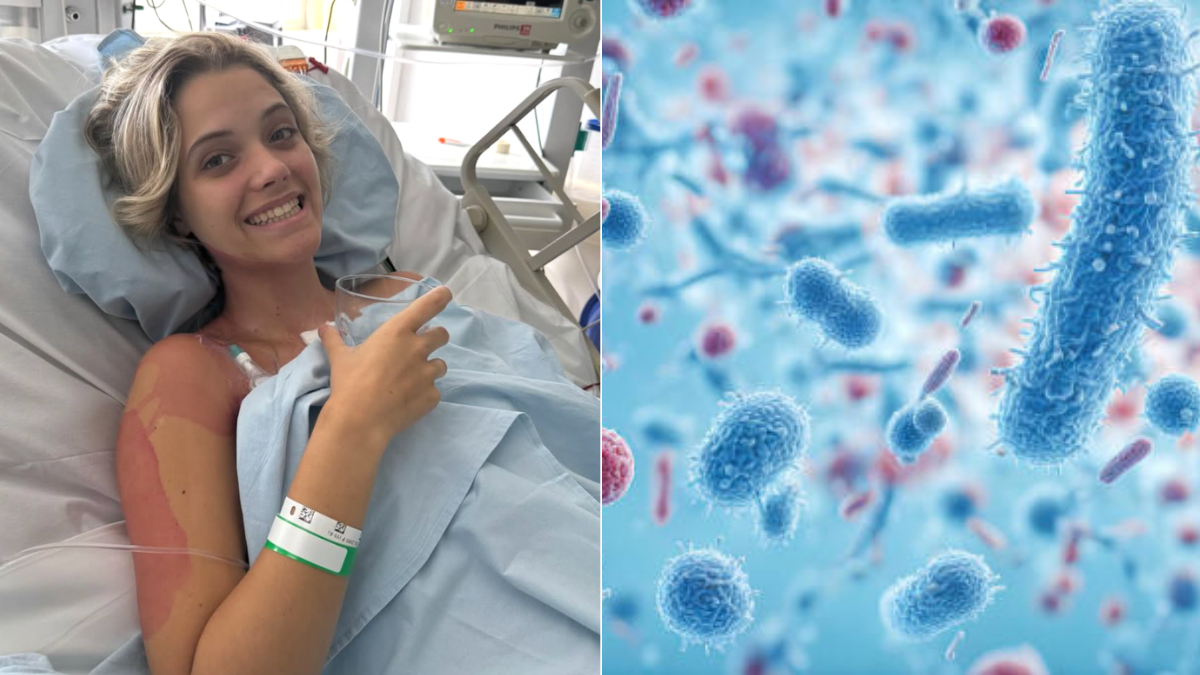 Le diagnosticaron un cáncer ultra raro a los 20 años que afecta a menos del 1 por ciento: este es el dolor agudo cerca del omóplato que la alertó