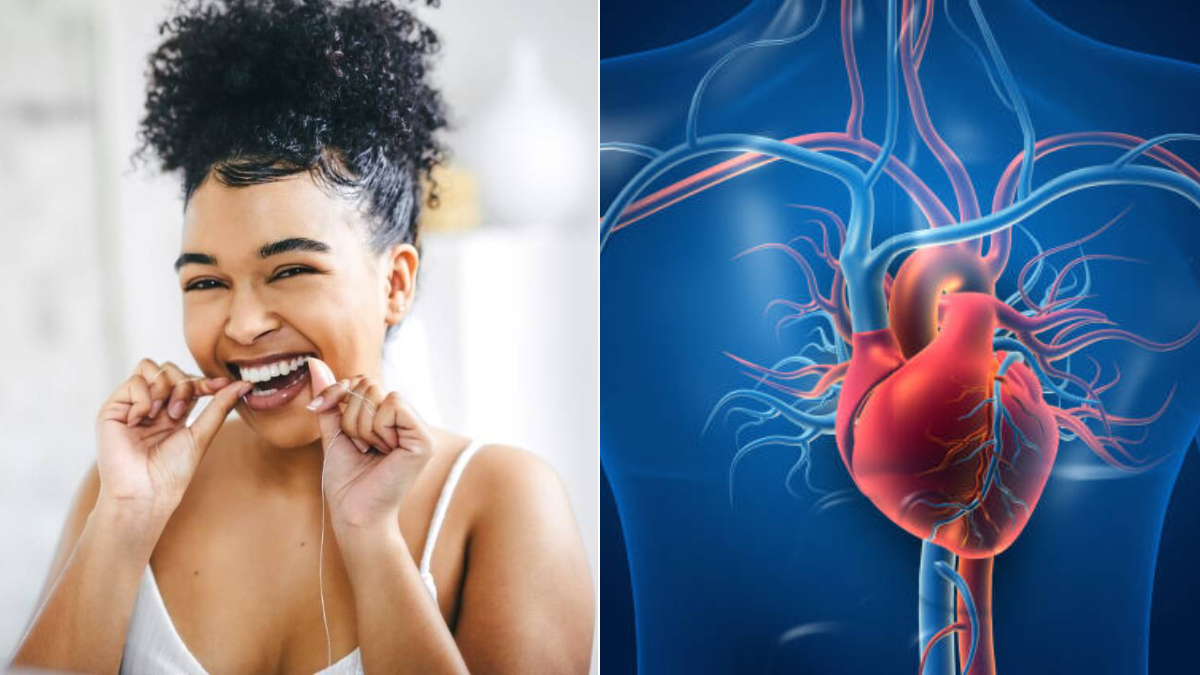 Usar hilo dental podría prevenir un infarto o un ACV: esto es lo que se sabe