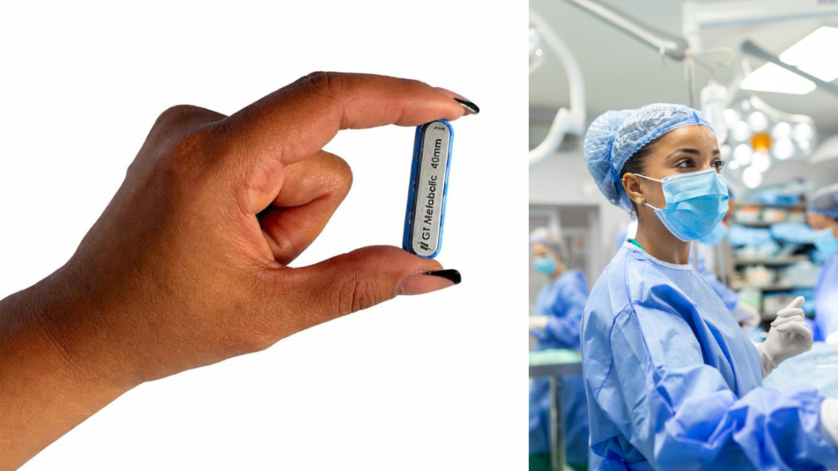 Los imanes que se comen y que reemplazan las cirugías bariátricas para adelgazar: ¿qué tan eficientes y seguros son?