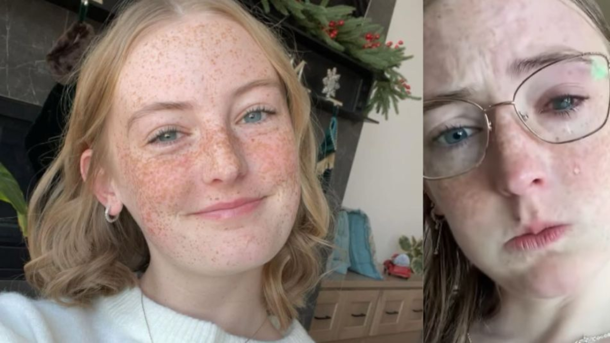 Mujer de 19 años perdió la vista tras ducharse con lentes de contacto: 'Es muy difícil vivir con ello'