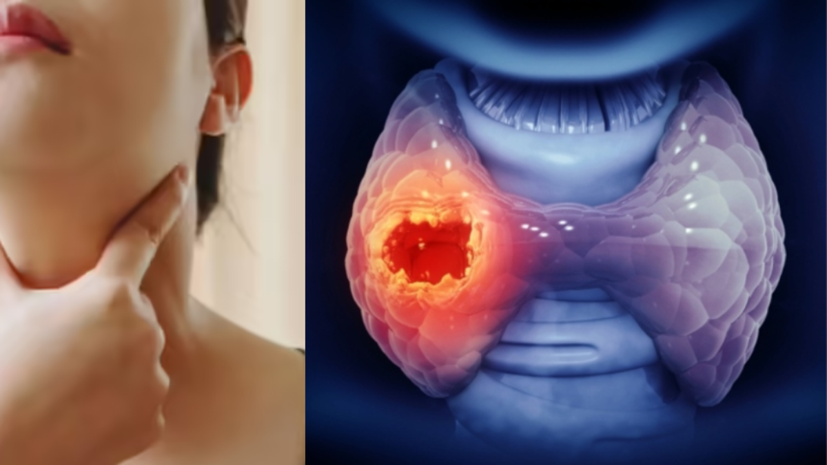 Hipotiroidismo e hipertiroidismo: las señales de alerta de la tiroides que toda mujer colombiana debe conocer