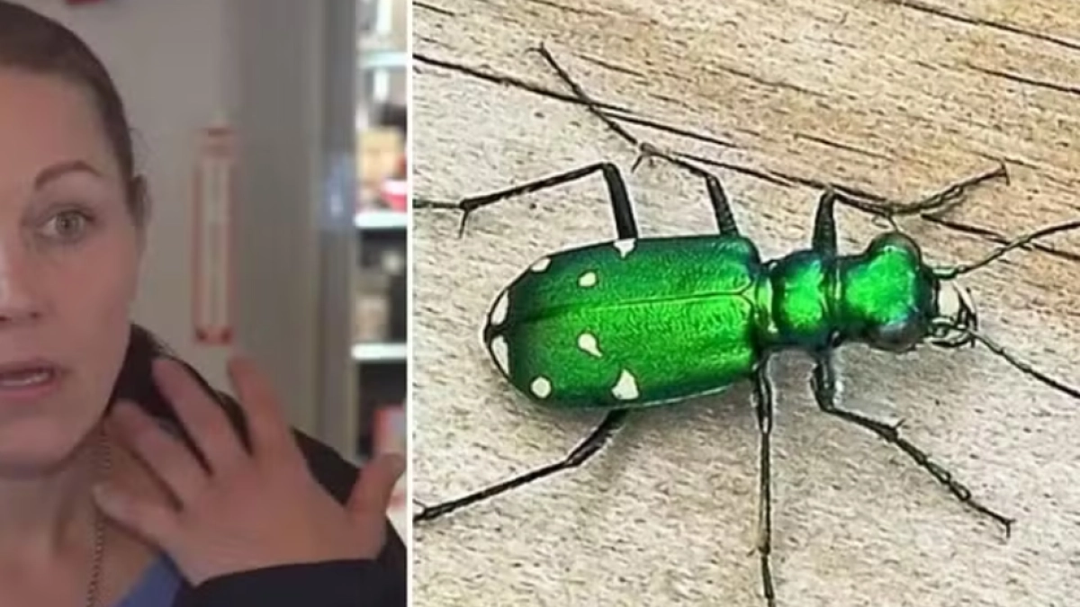 Mujer recogió un escarabajo 'bonito' en un parque y terminó en emergencia por una rara alergia que casi le cuesta la vida: 'Tenía los labios morados'