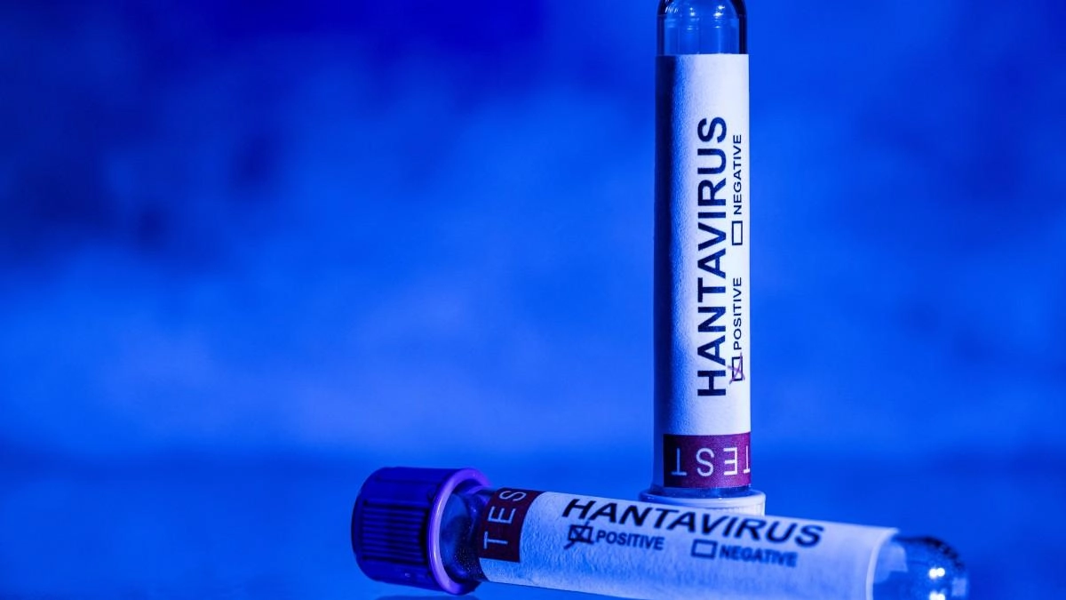 Reportan nuevo caso de hantavirus en España: un pasajero del crucero MV Hondius dio positivo, pero no reporta síntomas