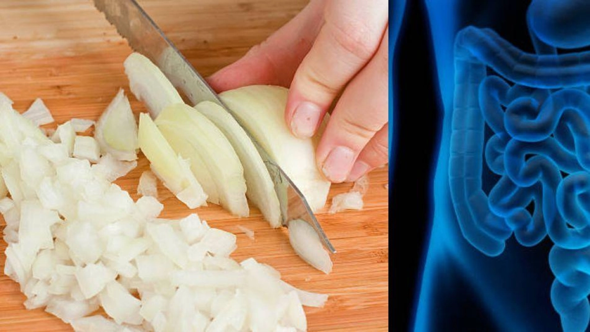 Compuesto de la cebolla podría ayudar a combatir el cáncer de colon, según estudio de la Universidad de Granada