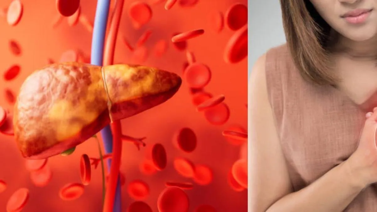 Estudio revela que el hígado graso eleva en un 69 % el riesgo de infarto y complicaciones cardiovasculares