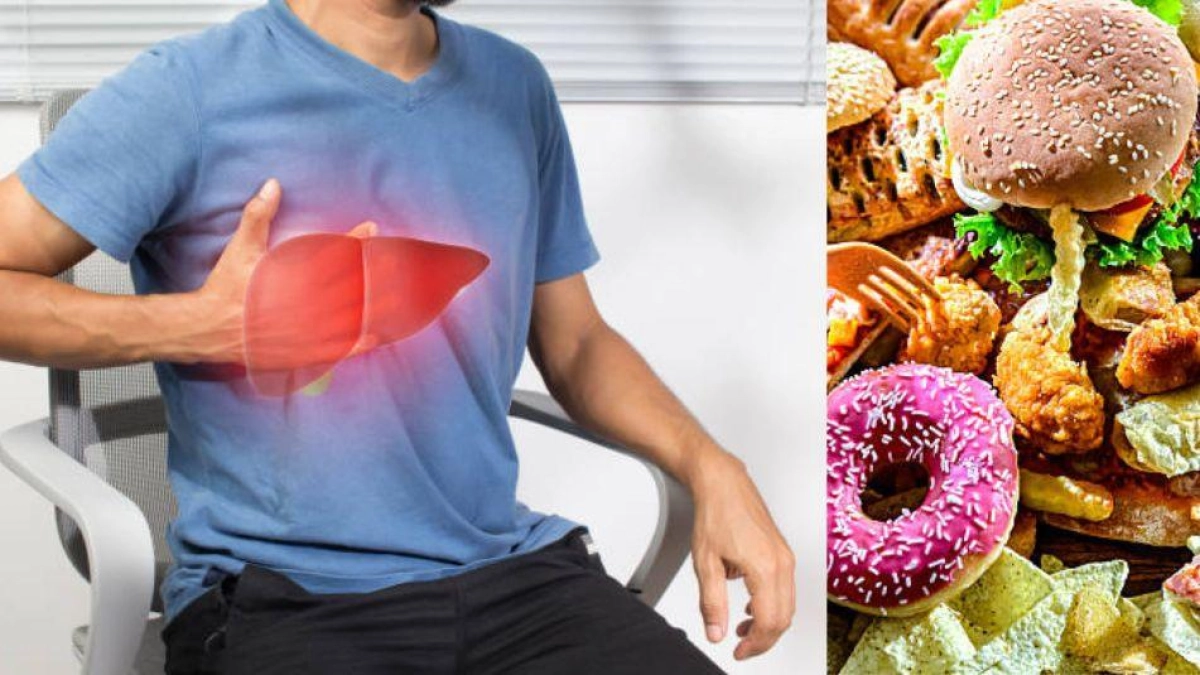 Hígado graso: alimentos de consumo diario que pueden acelerar su daño y riesgos para la salud hepática