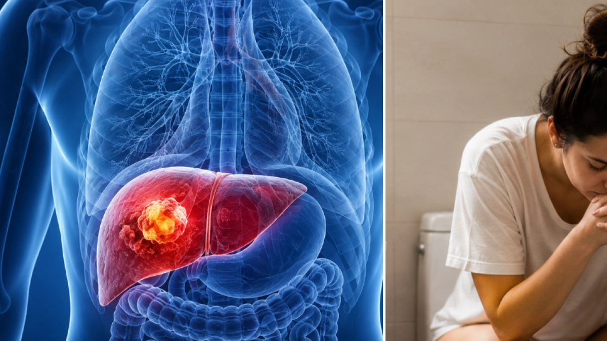Las 'pistas del baño' que muchas personas ignoran y que podrían estar relacionadas con el cáncer de hígado