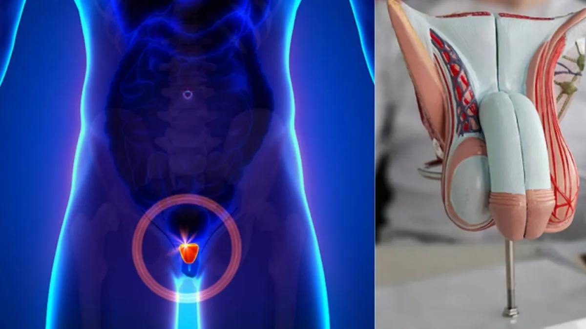 Cáncer de próstata: síntomas y cómo detectarlo antes de que avance