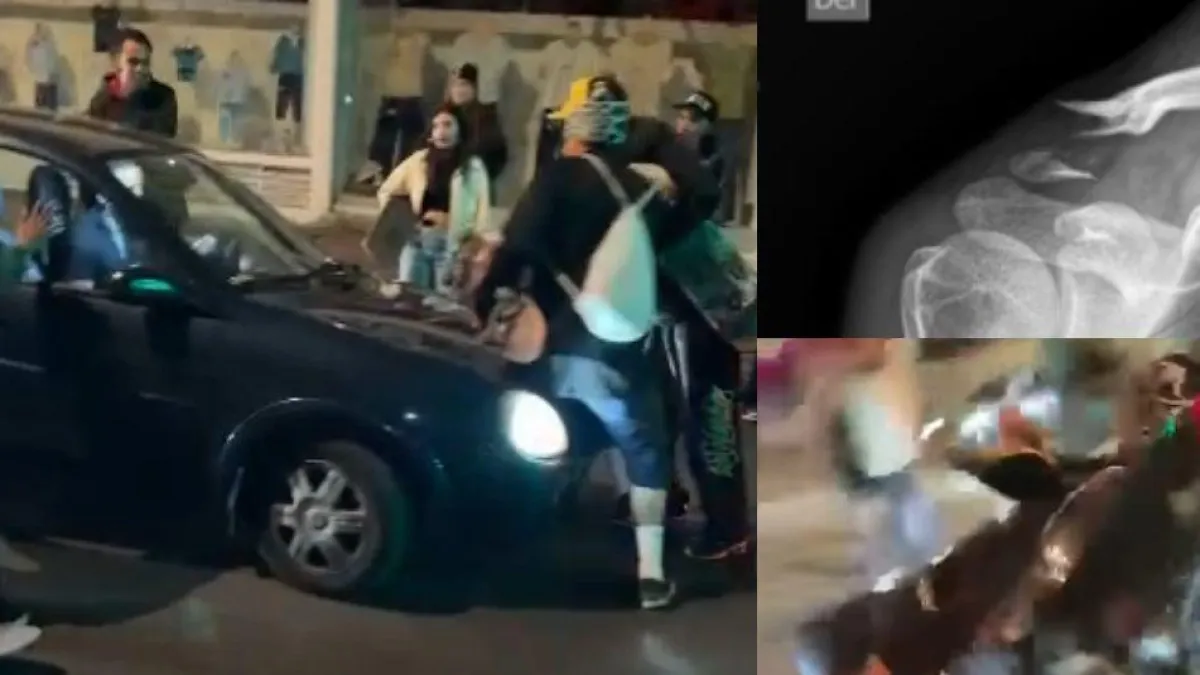 Jóvenes denuncian que resultaron heridos tras ser arrollados por un conductor que huyó en Bogotá: ‘Le decía que parara’