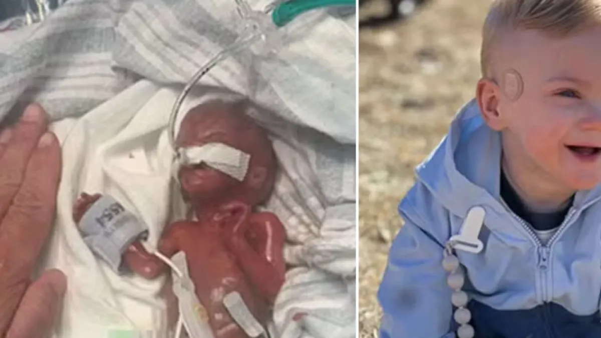 ¿Cómo está hoy el bebé más prematuro del mundo? Nació con 5 meses de gestación, tenía el tamaño de una mano y desafió los pronósticos médicos