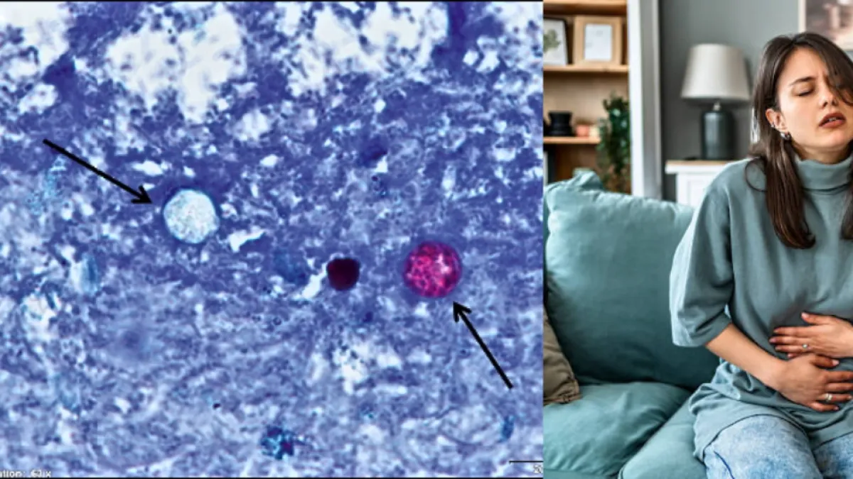 ¿Qué es la ciclosporiasis, cómo se contagia y cuál es su tratamiento? Claves sobre el brote que mantiene bajo alerta sanitaria a Estados Unidos