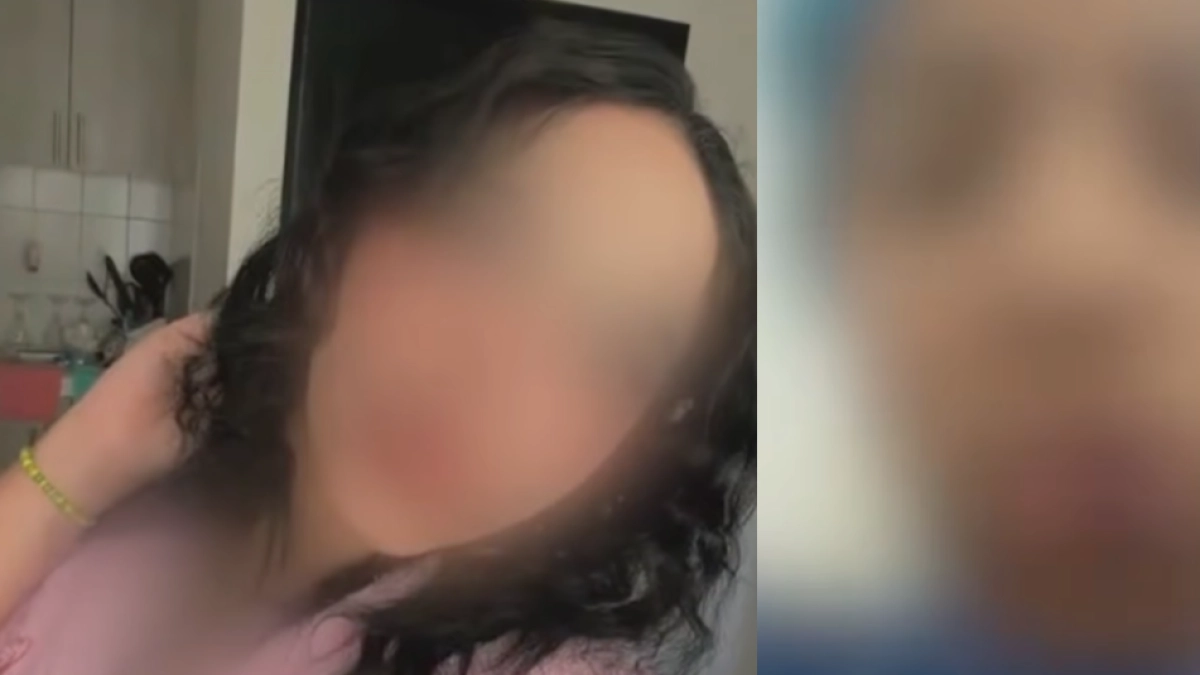 Joven de 25 años recibió un disparo en el rostro tras asistir a una primera cita con un hombre en el noroccidente de Bogotá: 'Apuntándole a la cara'