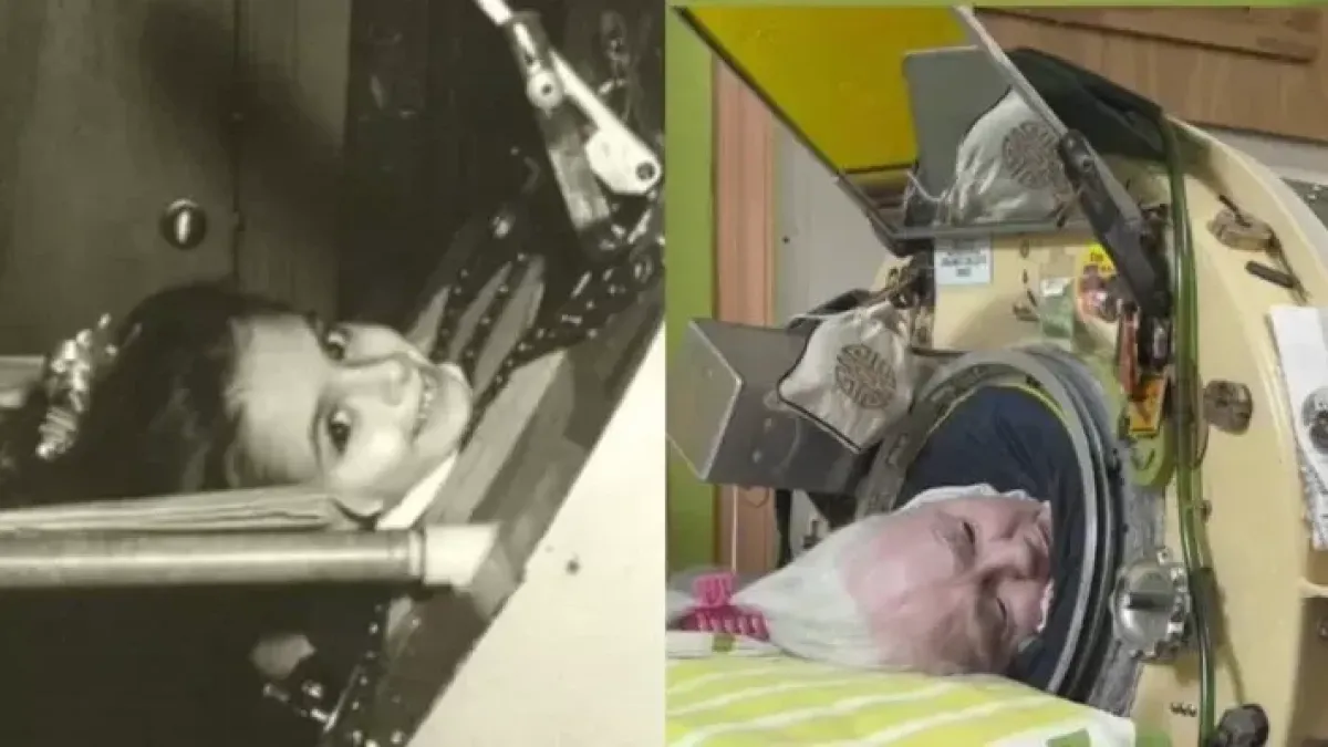 Muere Martha Lillard, la última paciente de polio de EE.UU. que usaba un pulmón de acero