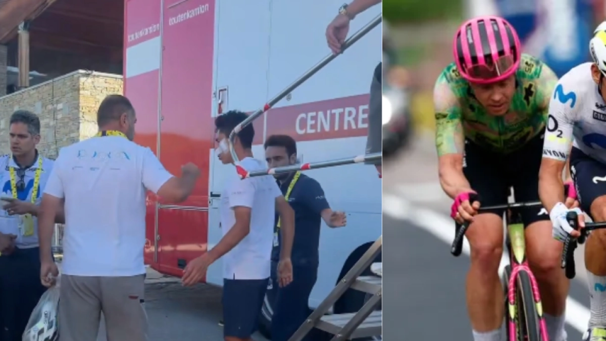 Video | Revelan estado de salud del ciclista Einer Rubio tras violento accidente contra un carro del UAE Team: le pusieron 20 puntos en el rostro