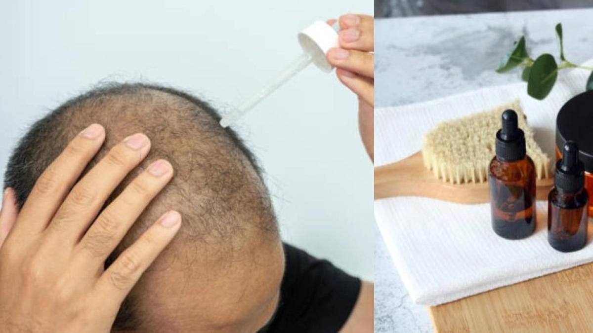 Invima alerta por venta ilegal del spray para la caída del cabello y pide suspender su uso: han reportado efectos adversos