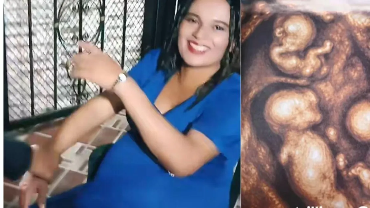 Mujer en Caucasia, Antioquia, gesta cuatro bebés varones con idéntica carga genética