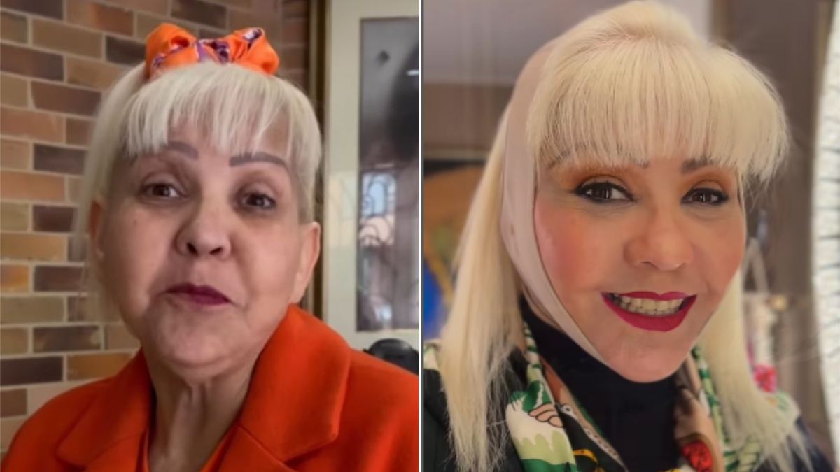 Así quedo la Gorda Fabiola tras cirugía de rostro: quedó irreconocible