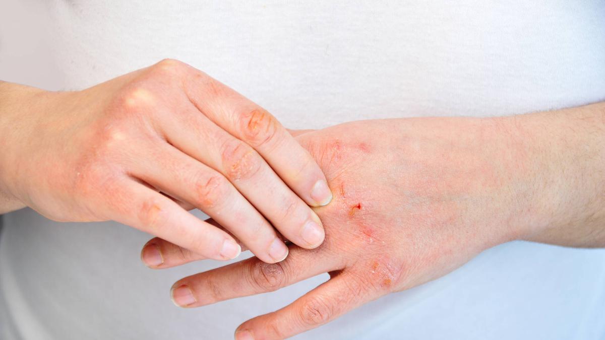 La ciencia revela el misterio de por qué algunos hombres tienen el dedo anular mas largo: está relacionado con su salud