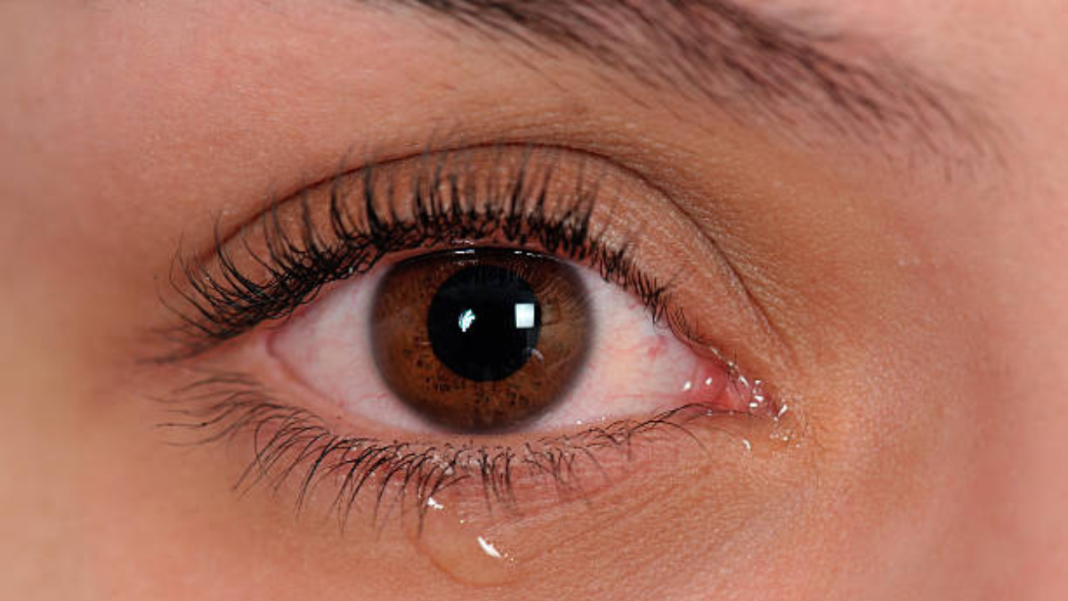 Ojos llorosos: ¿cuáles son los mejores remedios caseros para eliminarlos?