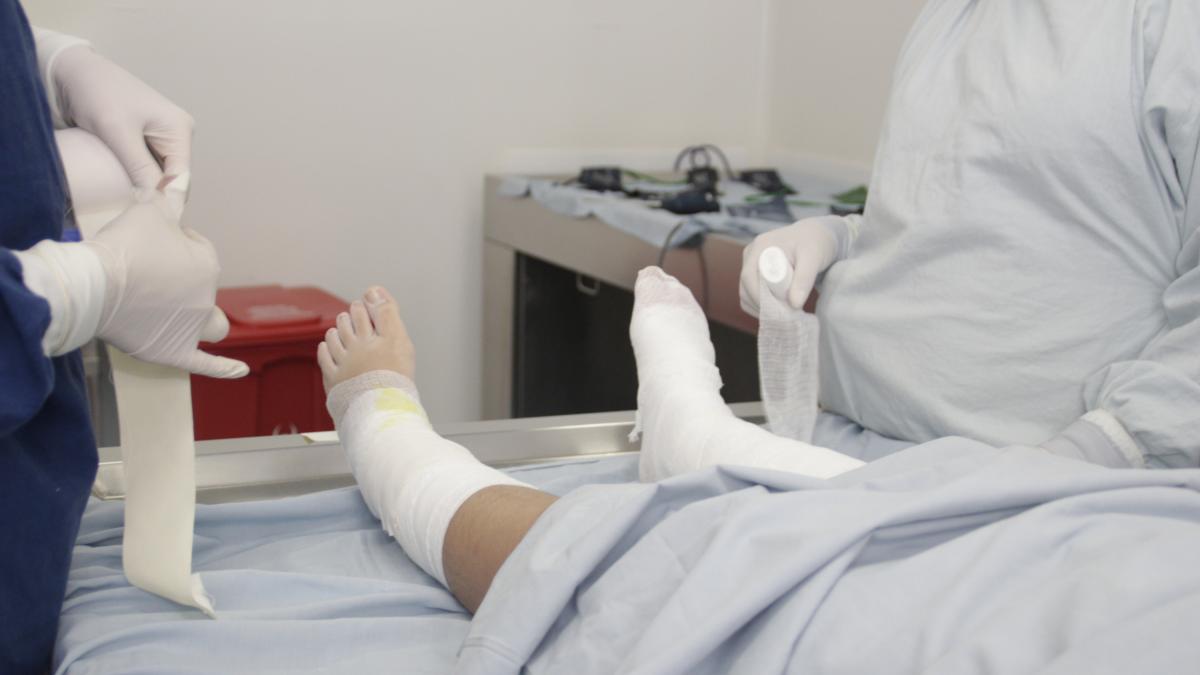 Entre enero de 2024 y julio de 2025 el hospital Simón Bolívar ha atendido a 34 personas quemadas con bioetanol, usado en chimeneas y calentadores