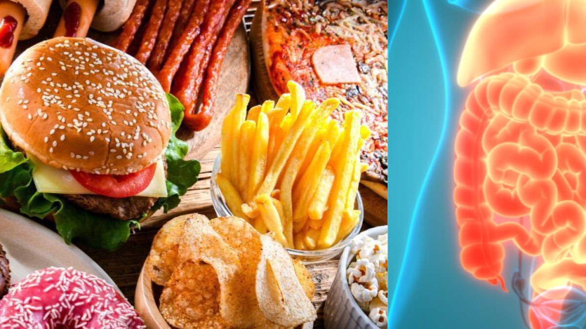 Los cinco riesgos de consumir alimentos ultraprocesados en exceso que pueden afectar la salud de manera silenciosa y progresiva, según expertos