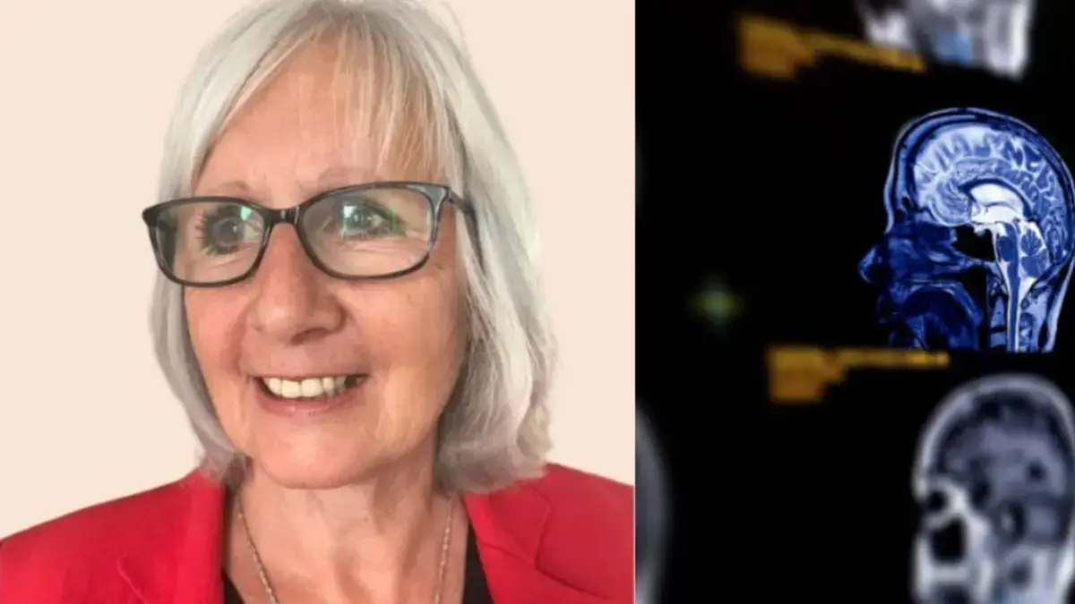 Mujer de 73 años sufre mareos ignorados por los médicos, y tiempo después descubre un tumor cerebral: comparte los dos síntomas que experimentó