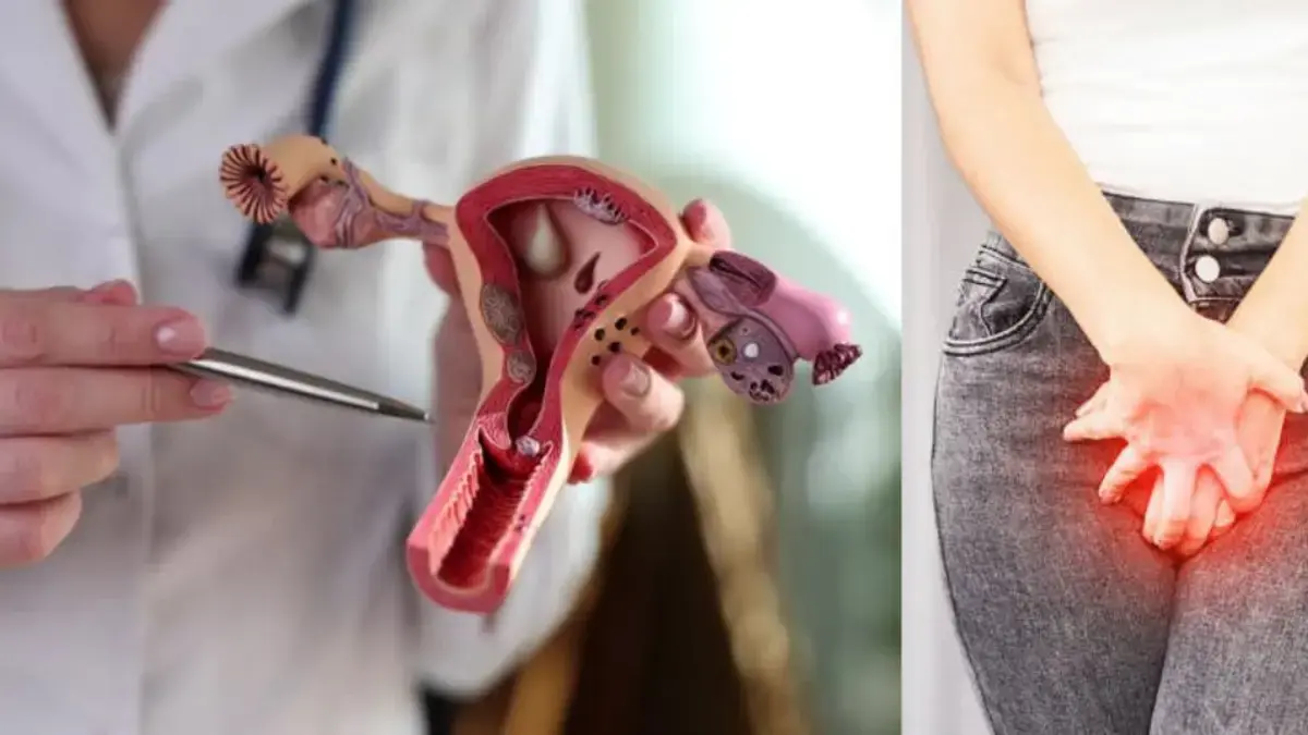 ¿Qué dice el color del flujo vaginal sobre su salud? Estas son las señales de riesgo