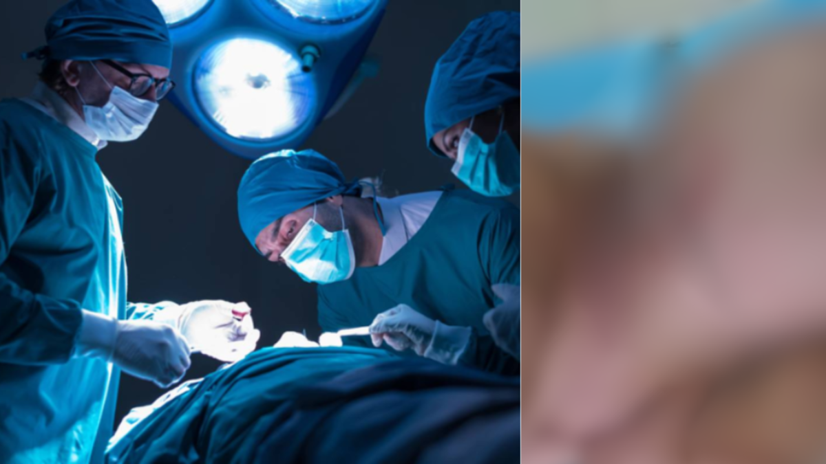 Le extirparon un tumor tan grande como 'una cabeza' a un hombre de 65 años que no buscó ayuda médica sino que usó remedios caseros