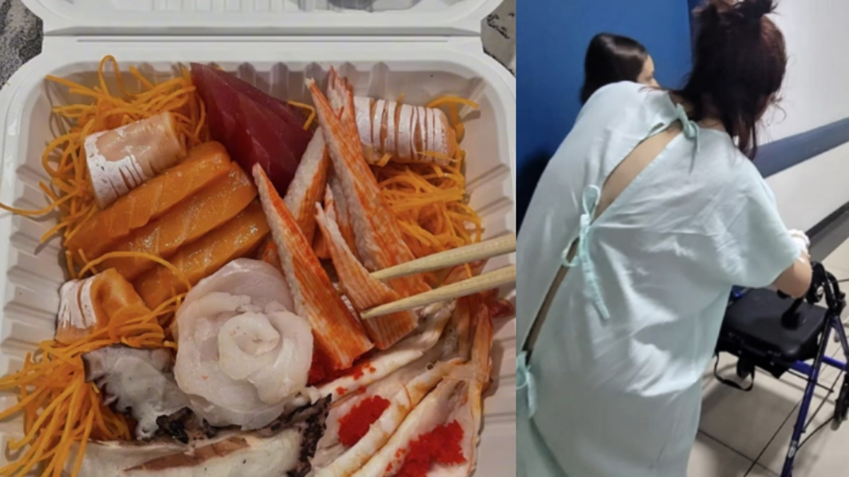 Comió sushi y adquirió una enfermedad mortal: 'Mi cara se derrite'