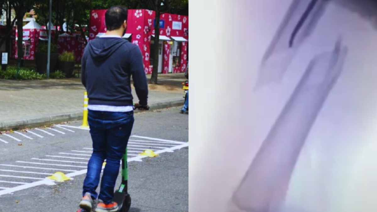 Niño de cinco años fue atropellado por una patineta eléctrica mientras transitaba en la ciclovía en Bogotá; el menor fue operado