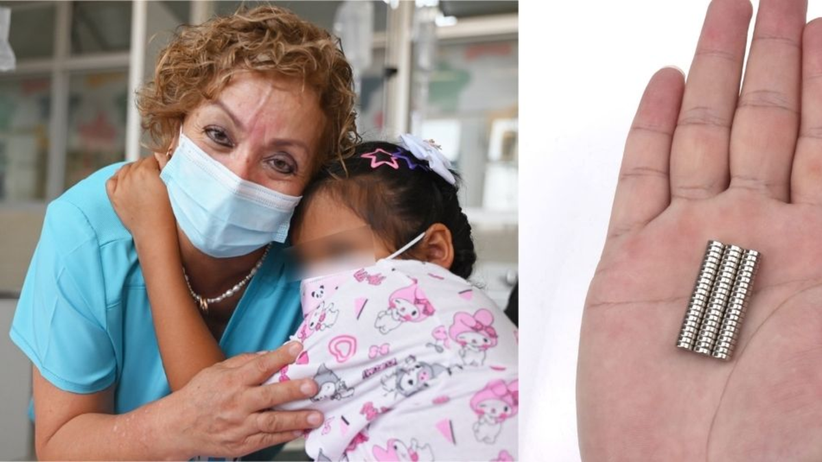 Alerta en centros pediátricos en Perú por ingesta de imanes de alta potencia en menores: niña de nueve años fue intervenida tras tragarse 20 piezas