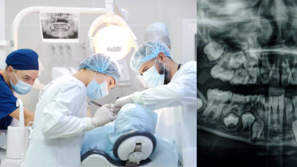 El caso del hombre que quedó sin dientes por un mal procedimiento dental: 'Sentí un dolor insoportable'