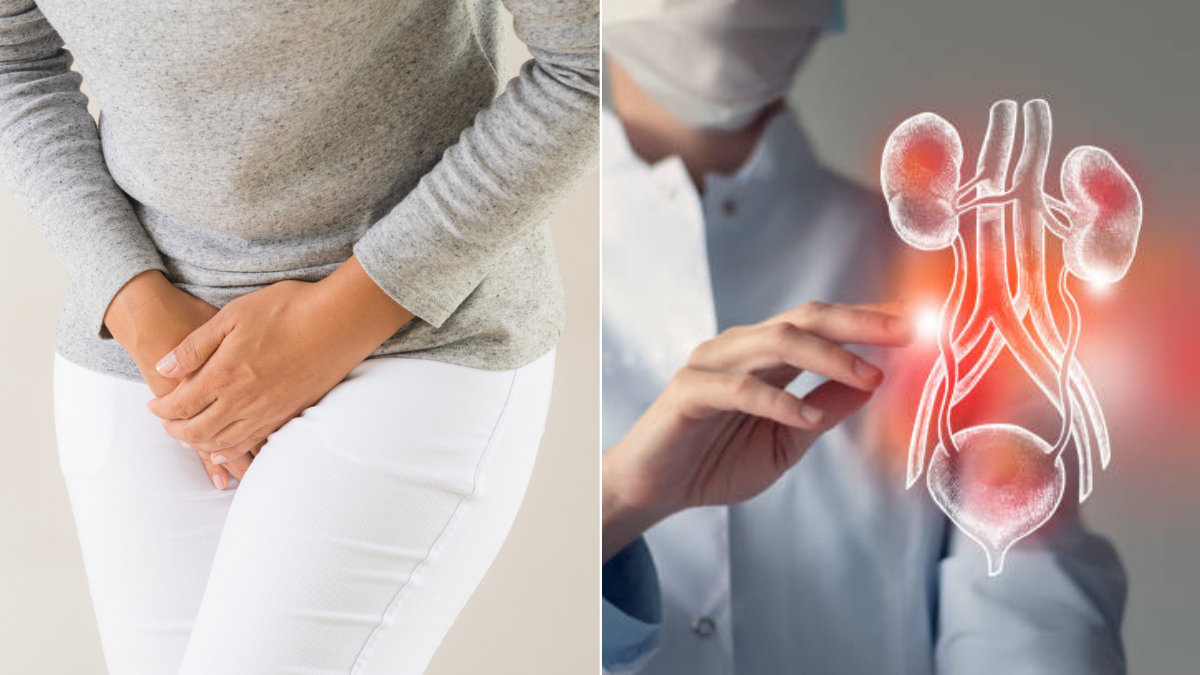 Orinarse al reír o toser no es normal: podría ser incontinencia urinaria y por qué es clave fortalecer el suelo pélvico