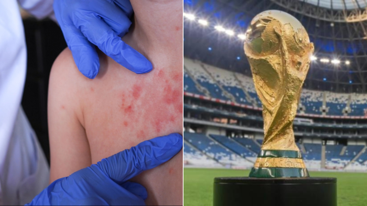 Alerta por posible expansión de una enfermedad contagiosa durante el Mundial 2026: piden reforzar vacunación y vigilancia epidemiológica