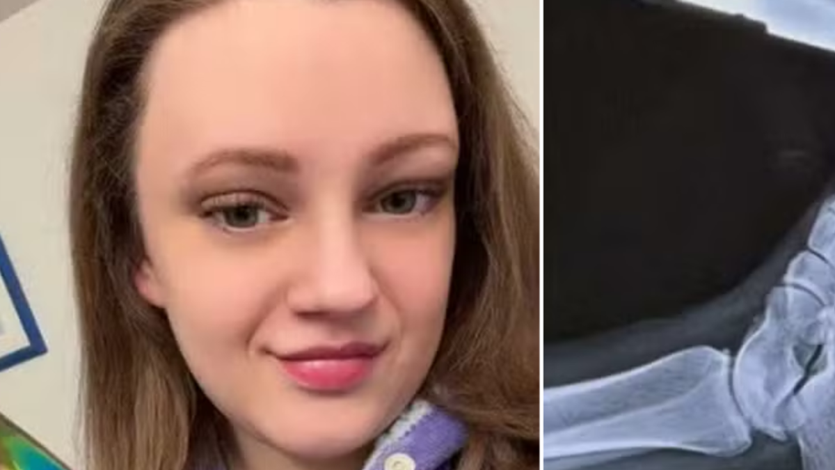 Mujer nunca imaginó que un accidente doméstico en la cocina le salvaría la vida: la lesión en el pie que la llevó a descubrir un quiste mortal