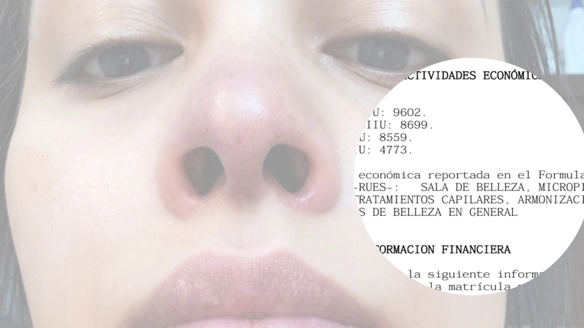 Mujer se sometió a una intervención en su rostro y ahora afronta graves afectaciones: dice que auxiliar de enfermería se hizo pasar por doctora