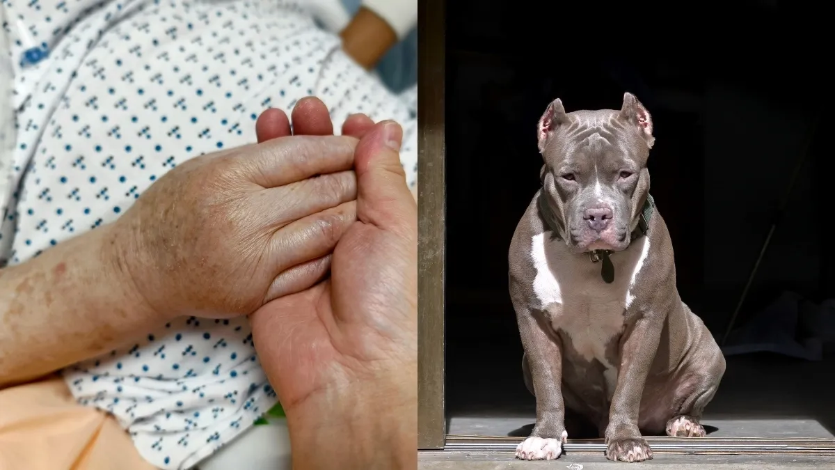 Brutal ataque de dos perros dejó a una mujer gravemente herida en Montebello, Antioquia: perdió dos dedos