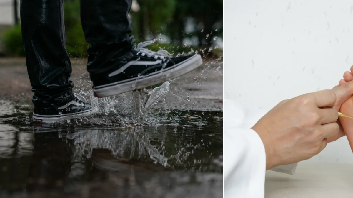 ¿Es peligroso pisar charco de lluvia? Esto dicen los expertos sobre hongos y humedad en los pies