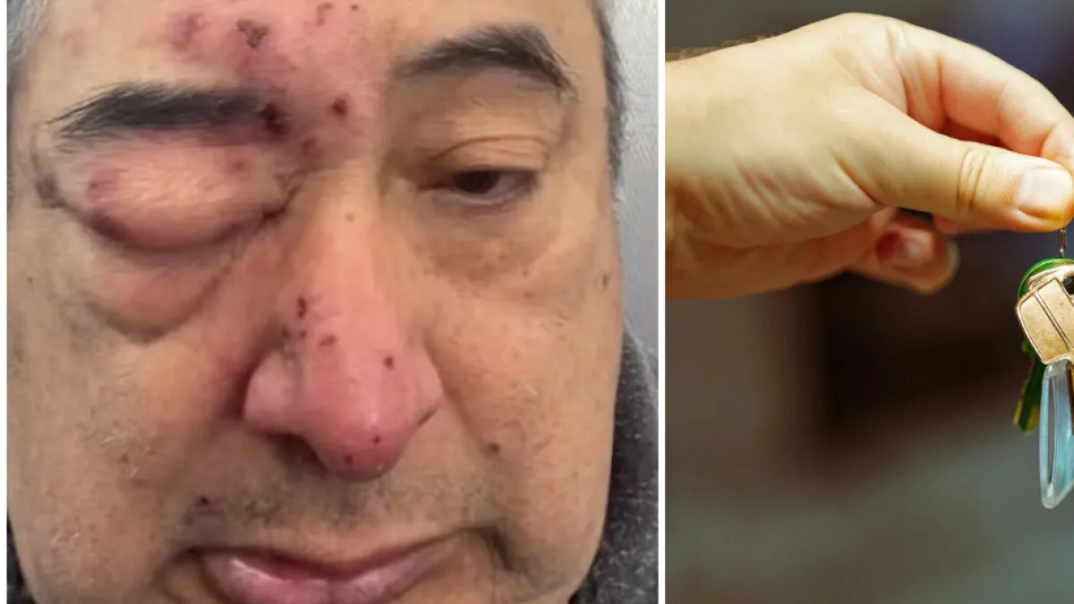 La pesadilla que vivió un inquilino recién mudado a un apartamento: terminó en el hospital y hasta fue vacunado