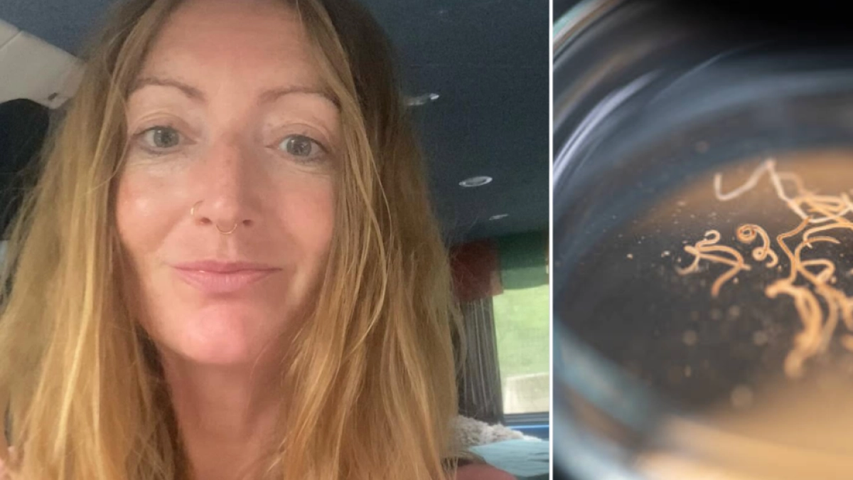Mujer viajó a India y años después descubrió 38 parásitos en su cerebro: una sola comida desencadenó una pesadilla de salud