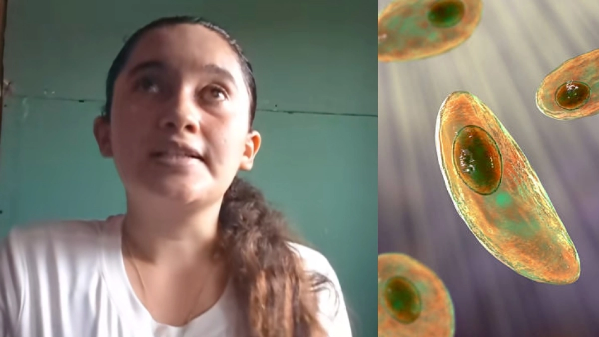Mujer cuenta cómo quedó ciega tras contraer toxoplasmosis: 'Se encuentra en frutas y verduras mal lavadas o carnes'