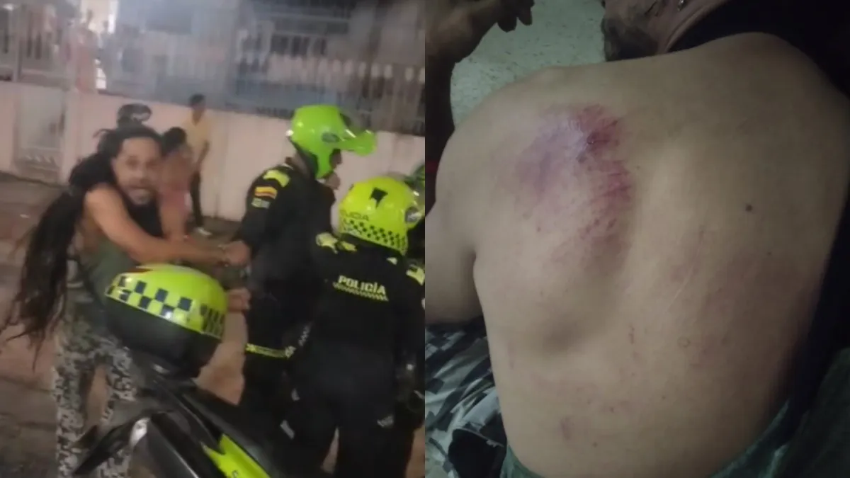 El operativo que enreda a la Policía de Cartagena: denuncian golpizas y uso de taser en manifestación por el servicio de energía
