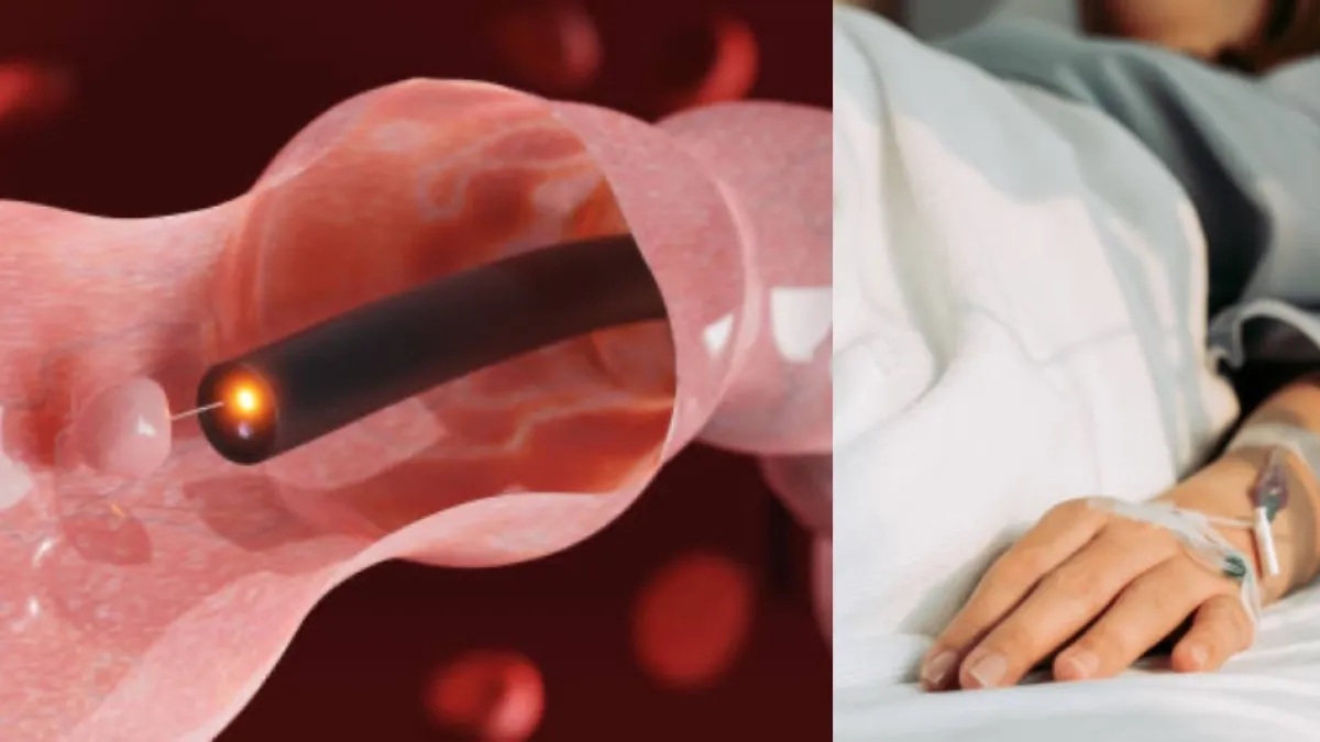 Acudió a un examen de rutina en Brasil y murió tras sufrir una perforación intestinal durante el procedimiento