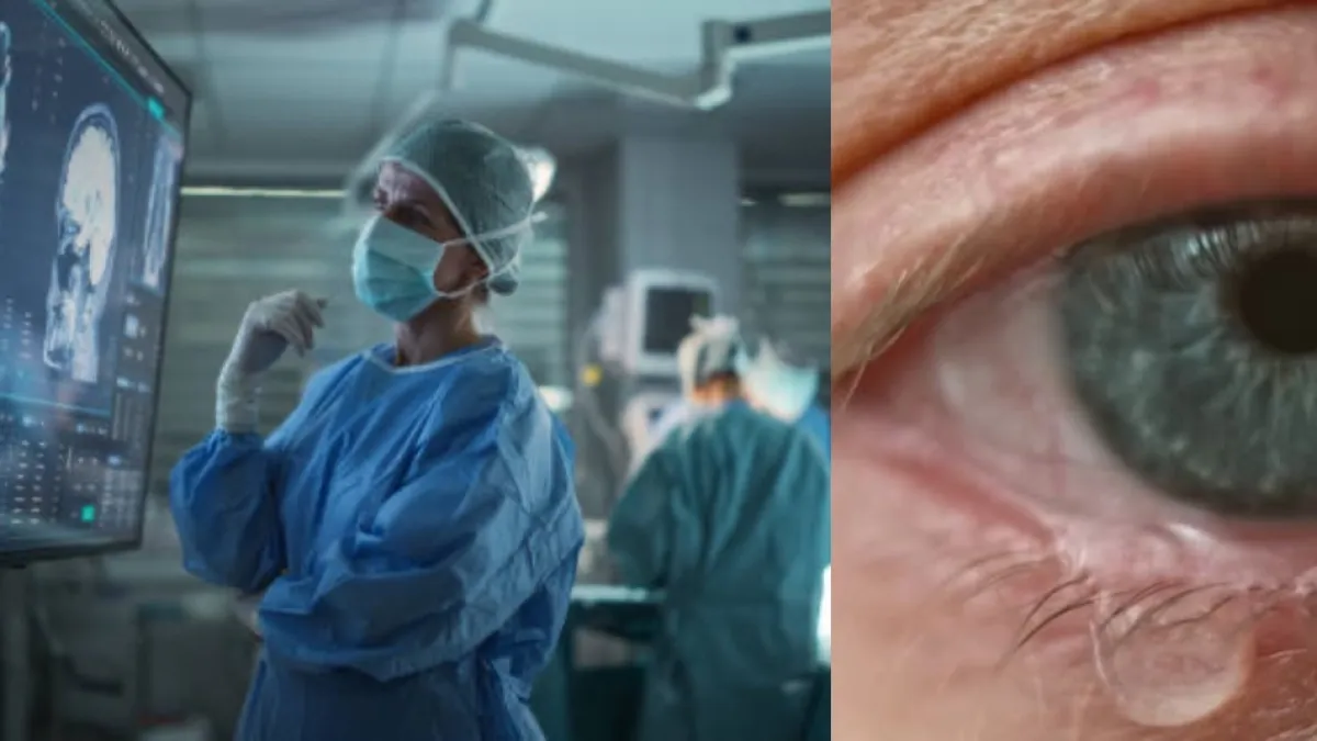 Su ojo lagrimeaba constantemente y le detectaron cáncer: ‘Si esto no se llevara a cabo, moriría’