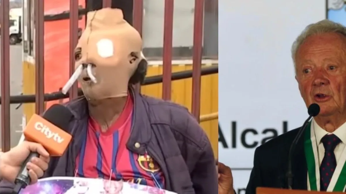 Arturo Calle ofreció ayuda para que María Consuelo Córdoba, mujer quemada con ácido, pueda comprar una casa: 'Quiero que ella tenga una vivienda'