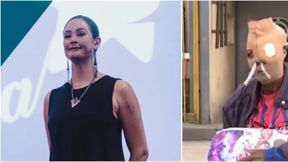 Natalia Ponce de León se pronunció sobre María Consuelo Córdoba, quien pidió la eutanasia tras un ataque con ácido: ‘Su situación es muy dolorosa’