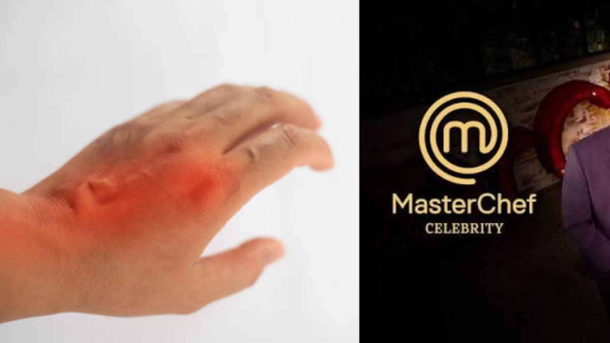 Participante de 'MasterChef Celebrity' sufrió grave accidente por descuido durante una prueba