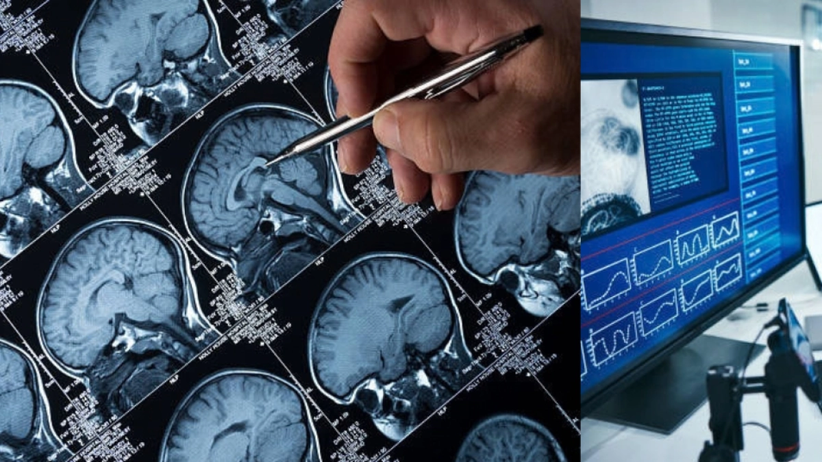 Estudio revela que el cerebro en realidad son dos órganos que evolucionan por separado