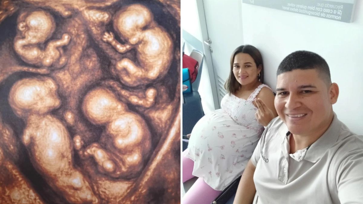 El milagro médico de uno entre 15 millones: la historia de los primeros cuatrillizos idénticos de los que se tiene registro en Colombia