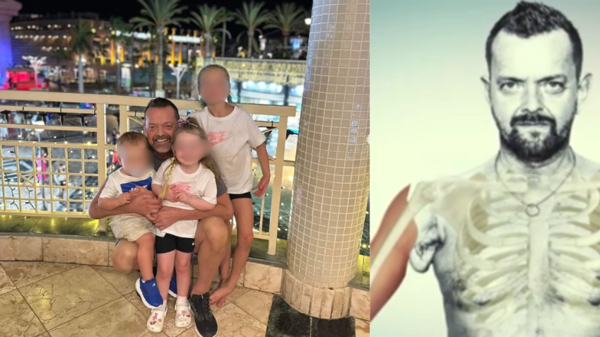 Perdió los dos brazos en un accidente y 23 años después, luego de un trasplante, logró abrazar a sus hijas y nietas: la historia que conmueve al mundo
